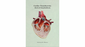 Omslag proefschrift Cardiac transthyretin-derived amyloidosis